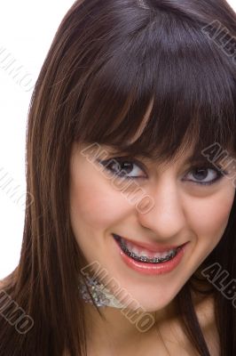 Beautiful young brunette with brackets on teeth 2