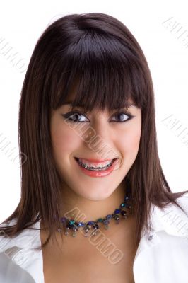 Beautiful young brunette with brackets on teeth 1
