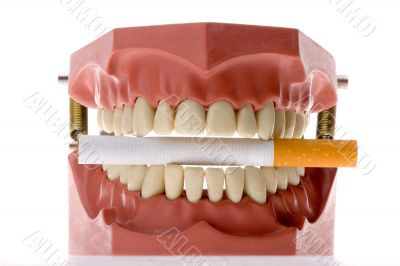 Dental mold biting a cigarette