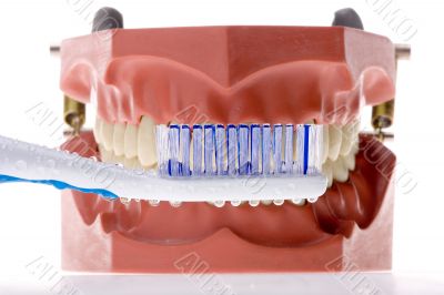 Dental mold and toothbrush 4