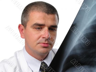 Doctor analizing a chest radiography