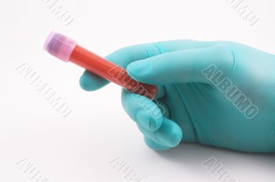 blood sample