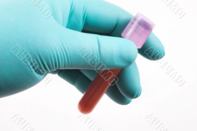 blood sample