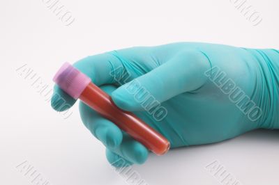 blood sample