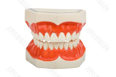 dentures, dental prosthesis