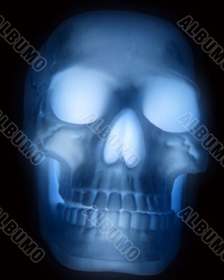 X-Ray X-Ray