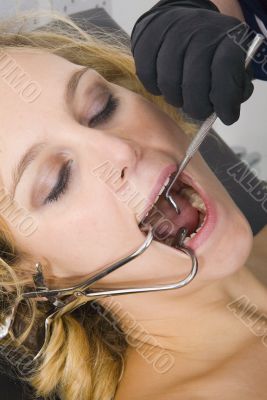 Dental Exam