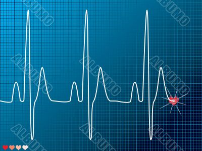 heart beat medical dark