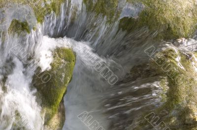 cataract