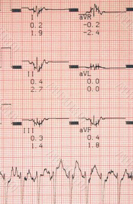cardiological tests results