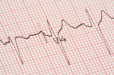cardiological tests results