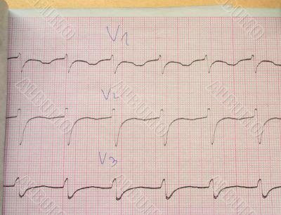 verify my ECG