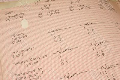 cardiological test results