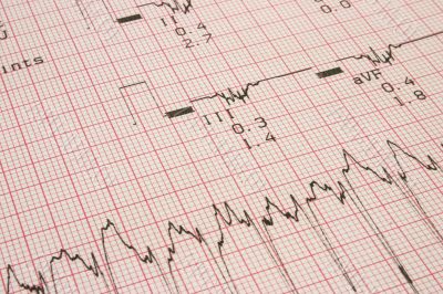 cardiological test results