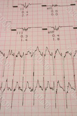 cardiological test results