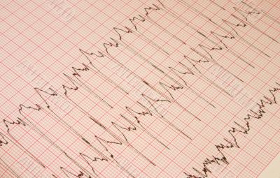 cardiological test results