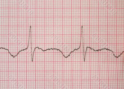 cardiological test results