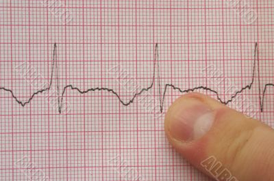 ECG with finger