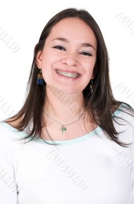 big smile with braces