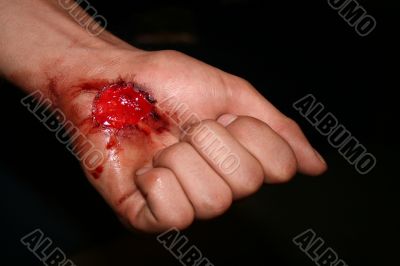 Wounded