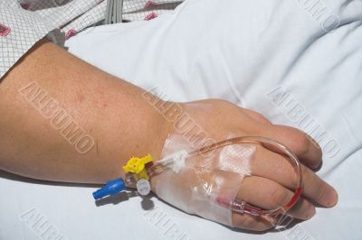 Patient with IV