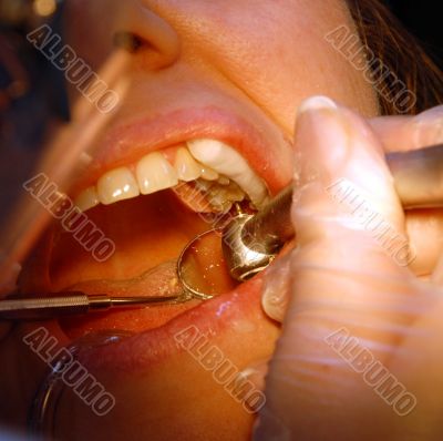 Patient in the dental clinic