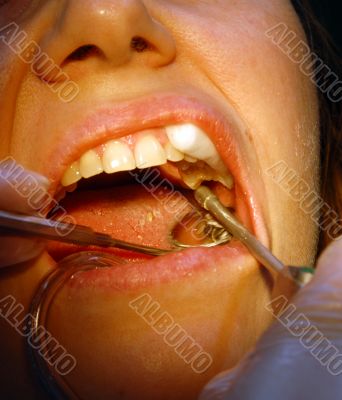 Patient in the dental clinic