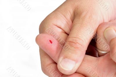 Thumb from a Bloody Finger