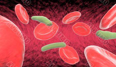 Blood cells and bacteria in artery