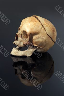 real skull