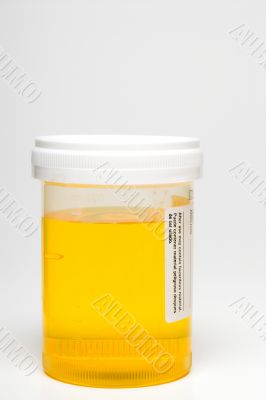 Urine Sample
