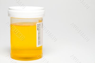 Urine Sample