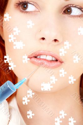 puzzle of lips enlargement procedure