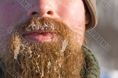 Ice in the beard
