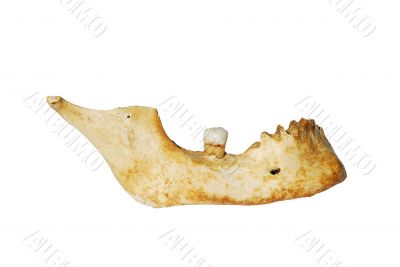 Human mandible with tooth