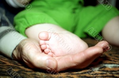 Infant foot and hand fingers with cracknel