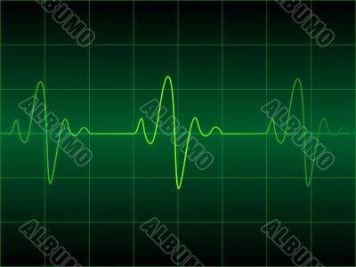 Heart cardiogram