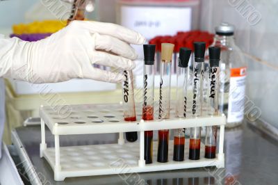 Blood analyses Blood analyses