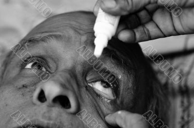 Eye Drops Eye Drops