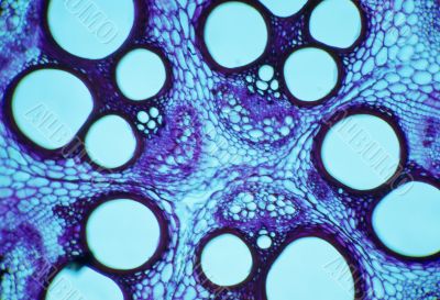 I See Spots. Micro cell