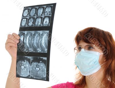 female doctor with tomogram