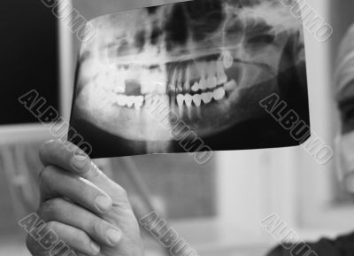 Doctor with x-ray Doctor with x-ray