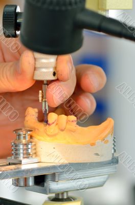 Dental technician measuring dentures