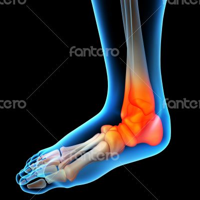 Ankle pain - detail