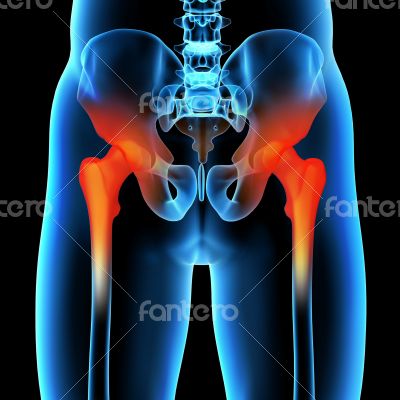 3d rendered illustration of a painful sacrum