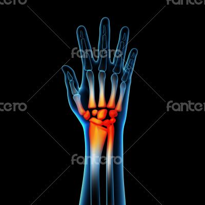 3d rendered anatomy illustration - hand pain