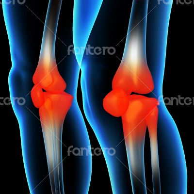 Human knee pain with the anatomy of a skeleton leg