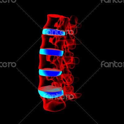 spinal disc