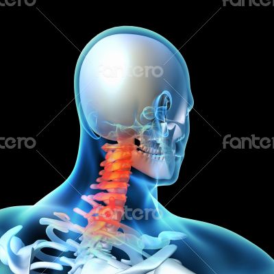 3d rendered illustration - painful neck 3d rendered illustration - painful neck