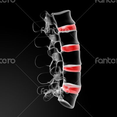 intervertebral discs
